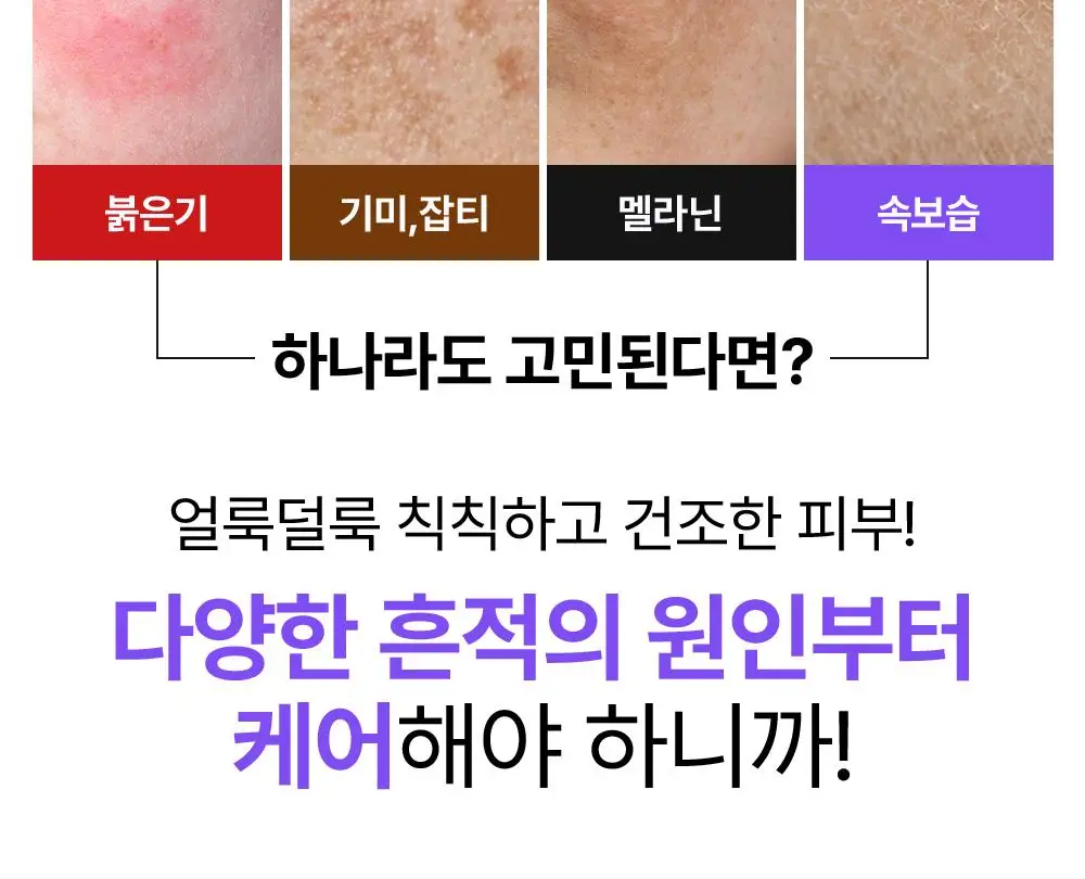 [나띠PICK][흔적케어크림] 더마펌 수딩 리페어 토닝 크림 R4 50ml 기획 (+30ml) 상세페이지 10